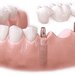 Aesthetic Dental Care - Clinica Stomatologica